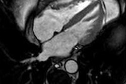 2013 07 23 12 22 48 615 2013 07 24 Radiotherapy Pic1 20130723195733