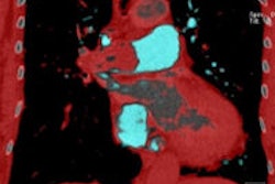 2013 07 26 10 36 59 461 2013 07 26 Pbv Vlahos Thumb