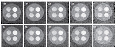 Phantom images acquired at 50 kVp with 1- (a, f), 10- (b, g), 20- (c, h), 30- (d, i), and 40-mm (e, j) thicknesses of PFC filters. The upper and lower rows include and exclude electronic noise, respectively.