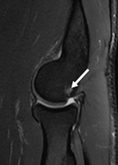 27-year-old male handball athlete