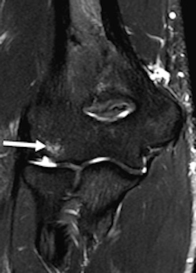 27-year-old male handball athlete