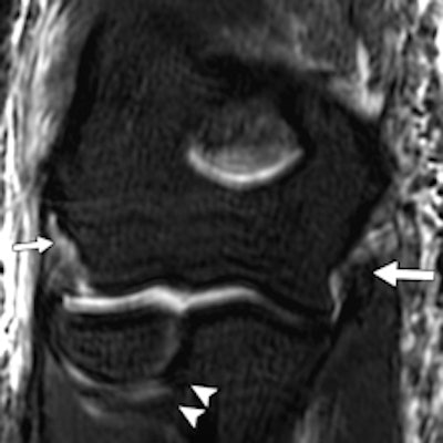 22-year-old female boxer