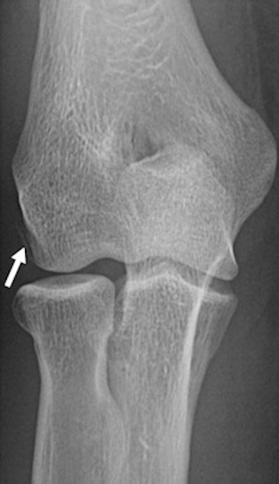 22-year-old female boxer