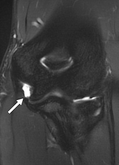20-year-old male weightlifter