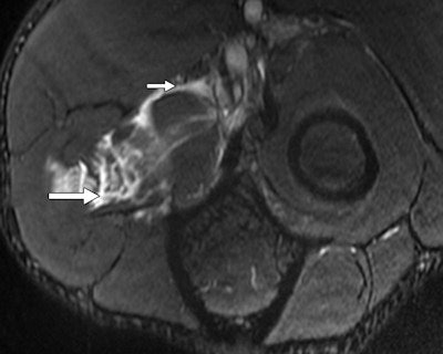 30-year-old male judo athlete