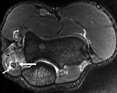 30-year-old male judo athlete