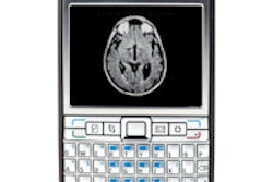 2013 08 08 15 37 22 867 Cell Phone Camera Brain Mri