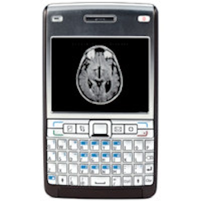 2013 08 08 15 37 22 867 Cell Phone Camera Brain Mri