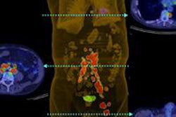 2013 08 13 16 10 53 703 Jnm Savi Merkel Cell 450 20130813231248