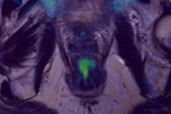 2013 08 19 09 18 19 454 2013 08 19 Dwi Mri Thumb