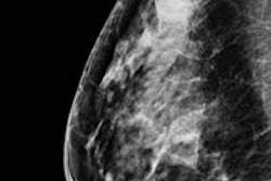 2013 08 22 15 10 22 708 2013 08 23 Young Breast Cancer Pic3 20130822221944