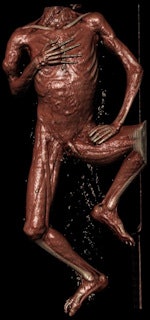 Digital autopsy