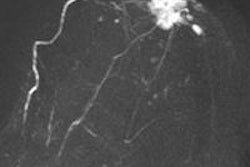 2013 09 13 11 56 58 885 2013 09 16 Mammo Kuhl Mipa 20130913190757