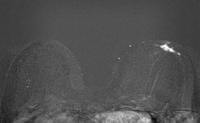 Fast MRI