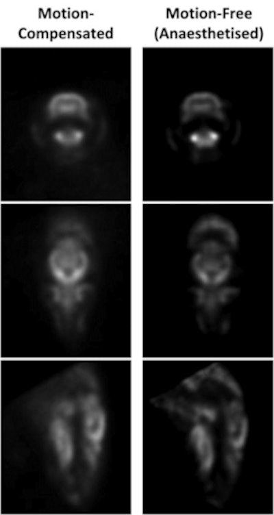 Motion-compensated PET images compared well to corresponding images from an anesthetized animal.