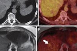 2013 09 20 09 28 16 962 2013 09 16 16 56 27 387 Pet Mri Ct Radiology Catalano 440 20130916235822
