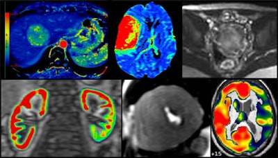 Perfusion imaging will come under scrutiny at JFR 2013, and will be the main theme of the Second Forum of Advanced Techniques on Monday 21 October.