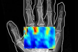 2013 09 25 12 26 14 26 2013 09 26 Ultrasound Thumb