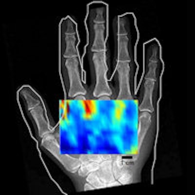 2013 09 25 12 26 14 26 2013 09 26 Ultrasound Thumb