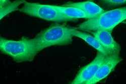 2013 09 30 10 41 54 748 Melanoma 200