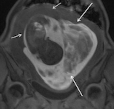 2013 10 03 09 14 26 437 2013 09 27 Pregnancy 1a