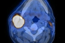2013 05 29 10 40 29 876 2013 05 29 Pet Ct Thumb