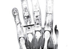 2013 09 30 13 51 47 593 2013 10 01 Idor Thumb