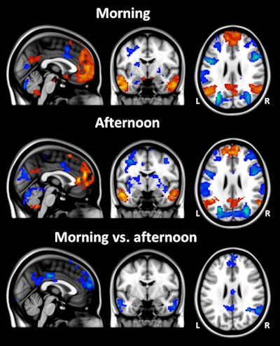 In the same group of subjects, the extent of resting-state activity differs between the morning and the afternoon. In a study conducted at KCL, half of the 16 subjects were scanned first in the morning and then in the afternoon, and the other half were scanned first in the afternoon and then in the morning. These average resting-state network maps show clear state-dependent differences in rsfMRI, which must be taken into consideration in future study designs. All images courtesy of Steve Williams, PhD.