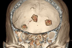 2013 10 09 09 29 29 137 10 09 Brain Stone Thumb