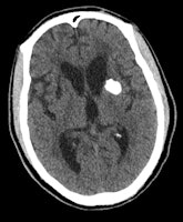 enhanced CT