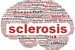 2013 10 11 11 56 14 835 Multiple Sclerosis 200