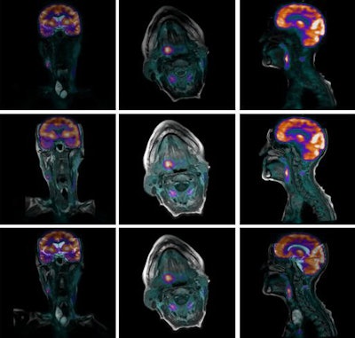 PET-MRI