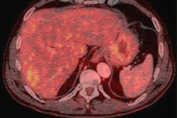 2013 10 30 10 43 26 640 2013 10 30 Pet Ct Market Thumb2