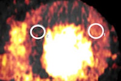 2013 11 01 12 27 21 531 2013 11 04 Dual Source Ct Rhumb