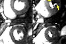 2013 11 04 14 31 43 70 2013 11 05 Cmr Thumb