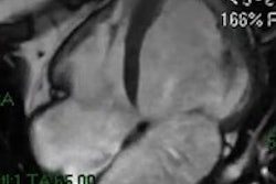 2013 11 12 11 25 20 520 2013 11 12 Italian Mri Thumb