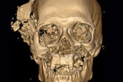 2013 11 18 13 44 42 170 2013 11 19 Ct Insider Thumb