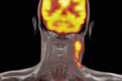 2013 11 22 09 31 37 964 2013 11 22 Pet Mri Thumb