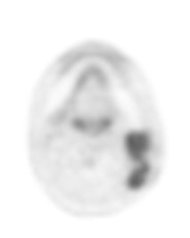 ADC