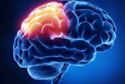 2013 11 27 14 42 36 929 Brain 200