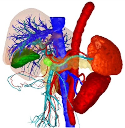 The Quantitative Imaging in Oncology research network is one of the eight research networks featured in the RSNA exhibition. It has developed a workflow software solution that creates visualizations, schematics, and statistics according to quantitative criteria based on image data. Image courtesy of BMBF.