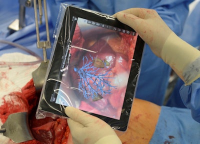 The Fraunhofer Institute for Medical Image Computing MEVIS helps facilitate the safe use of tablet computers to access data during surgical procedures. Image courtesy of Fraunhofer MEVIS/Fabian Bimmer.