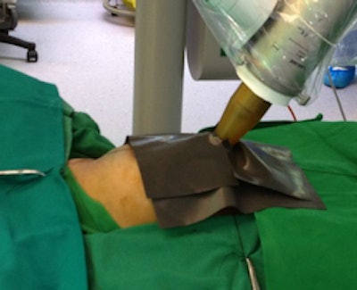 Saudi Arabia now offers intraoperative radiation therapy. Image courtesy of Dr. Yasir Bahadur.