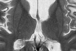 2013 12 20 13 25 12 791 2013 12 23 Mri