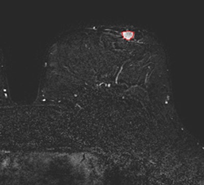 2013 12 11 15 47 42 848 Invasive 250