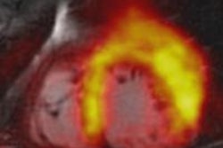 2014 01 09 13 16 04 878 2014 01 10 Pet Mri