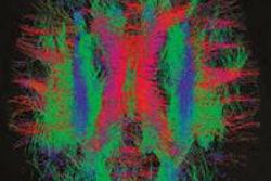 2014 01 13 13 48 07 738 2014 01 14 Medphyweb Brain Fibres 20140113205213