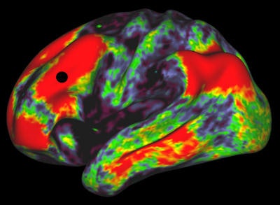 Functional MRI reveals the connection strengths from the black dot to the rest of the brain. This image is from the Human Connectome Project and shows an adult brain. Image courtesy of Human Connectome Project.