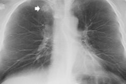 2014 01 24 11 34 57 689 2014 01 27 Tomo Thumb