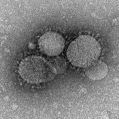 MERS-CoV as seen by negative stain electron microscopy. Image courtesy of the U.S. Centers for Disease Control and Prevention.
